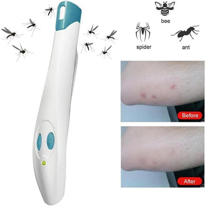 Portable Anti-Itch Pen for Bug Bites – Electronic Relief Device for Mosquito, Bee, Spider & Ant Stings, Chemical-Free Pain Relief, Instant Soothing (White) - Image 2