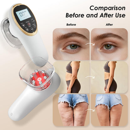 Modern Jingluo Beauty Massager – Electric Meridian Facial & Body Roller with Gentle Suction and Warmth, Multi-Speed Skincare Tool for Relaxing Rituals (White) - Image 6