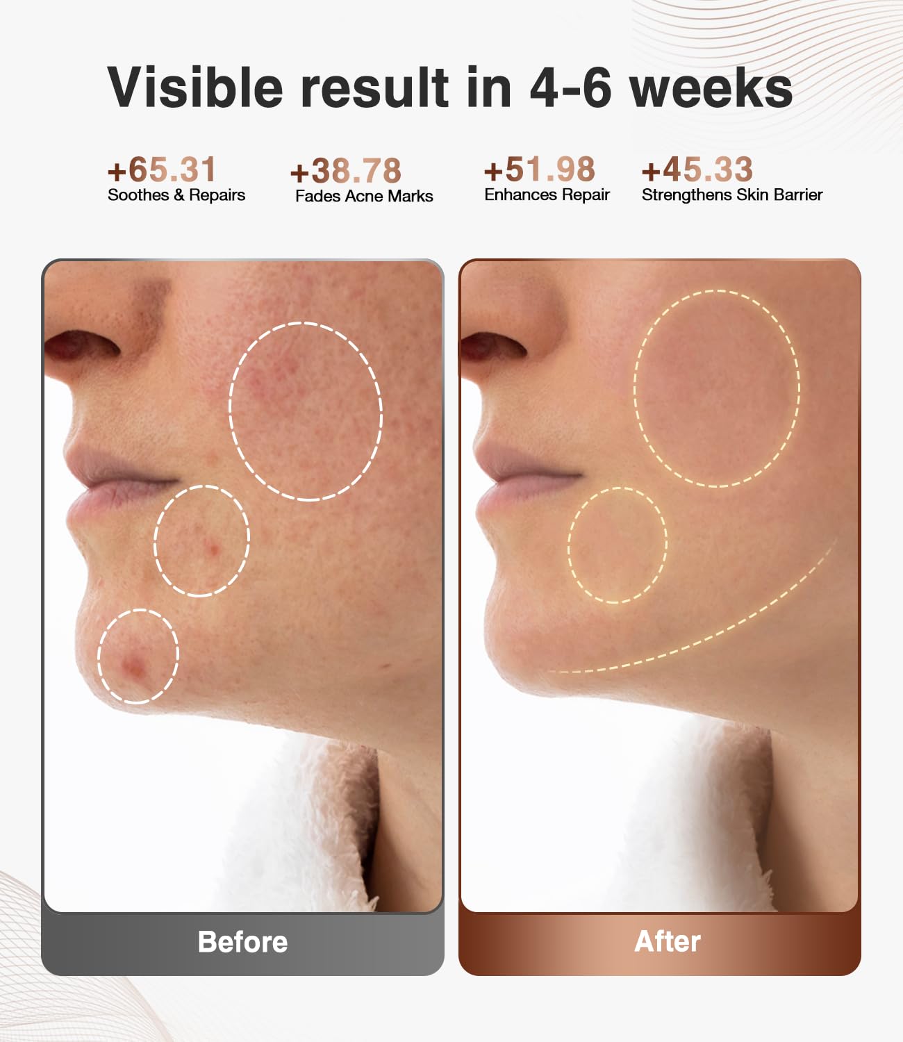 High-Performance 3D LED Beauty Mask – 4 Light Modes, 328 LEDs, Wireless Operation, Adjustable Timer, Lightweight & Flexible Fit – Reveal Radiant Skin (Brown) - Image 2