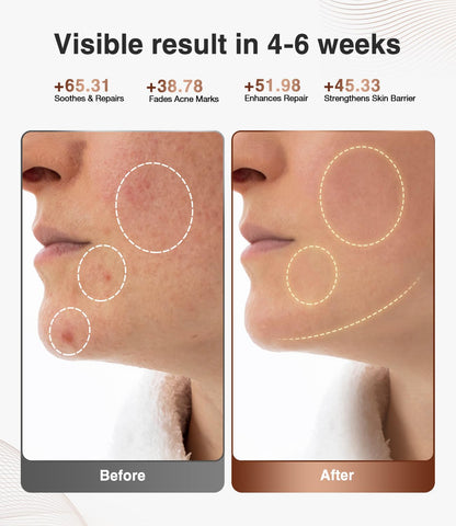High-Performance 3D LED Beauty Mask – 4 Light Modes, 328 LEDs, Wireless Operation, Adjustable Timer, Lightweight & Flexible Fit – Reveal Radiant Skin (Brown) - Image 2