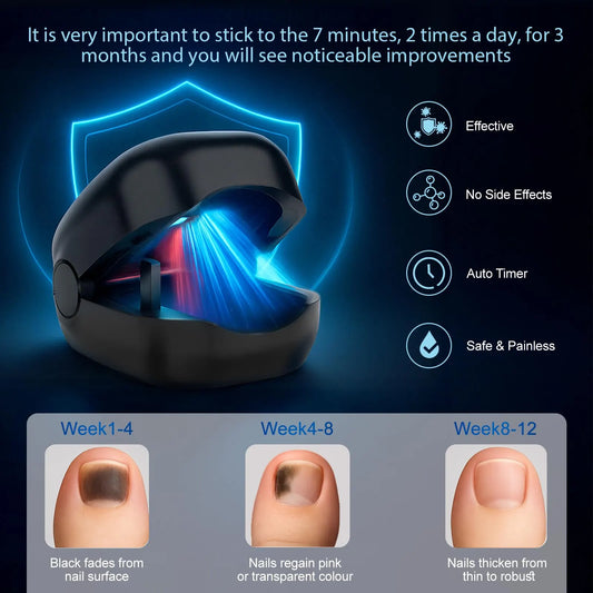 Nail Wellness Light Device (1-Piece): Red & Blue LED for Daily Nail Care Routine – Auto Timer, USB Rechargeable (Black) - Image 2