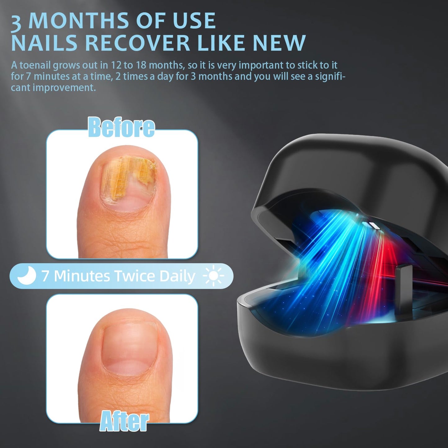 Nail Wellness Light Device (1-Piece): Red & Blue LED for Daily Nail Care Routine – Auto Timer, USB Rechargeable (Black) - Image 3
