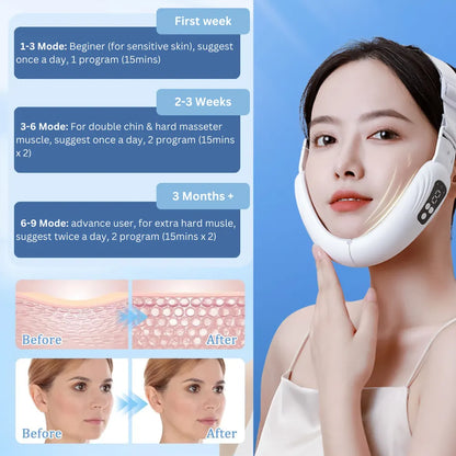 V-Face Shaping Massager Electric 9 Mode Lifting Reduce Slimming Double Chin - Image 7