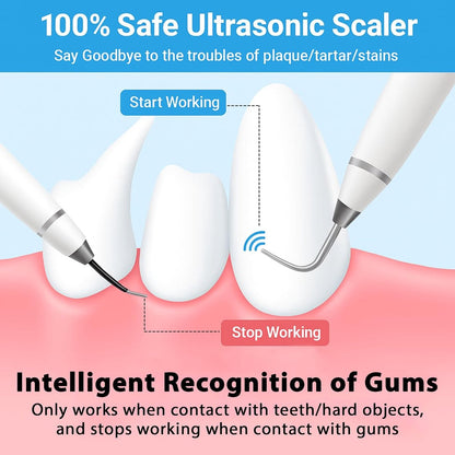 Electric Dog Toothbrush - Dental Cleaning Tools - Dog Toothbrush Set with LED Light - Rechargeable Dental Device, Anti-Plaque for Dogs and Cats - Wit - Image 5