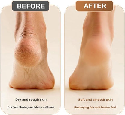 Electric Foot File - Removes Calluses and Dead Skin - Powerful Exfoliation - Built-in LED Light - Regenerative Exfoliation - Removes Calluses and Hard Skin - Wit - Image 7