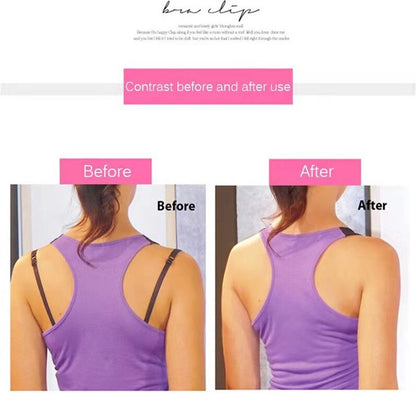 Bra Clip - Set of 3 pieces - Bra Buckles - Hot Sale - Fashion - Closure - Strap Clip - Invisible Bra Buckle - Holders - Strap - Clips - Image 4