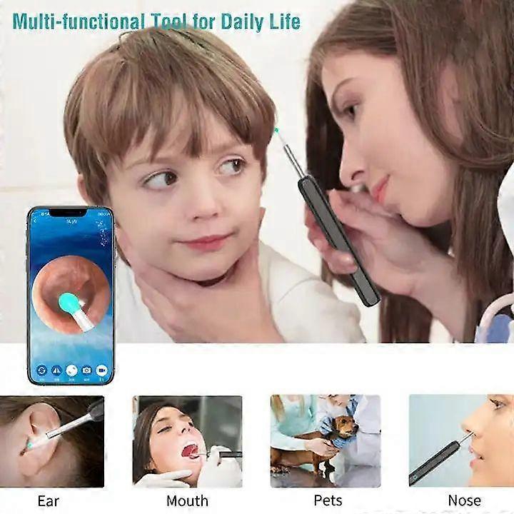 Wireless Smart Visual Ear Cleaner Usb WiFi Otoscope TW1 Ear Wax Removal Tool Set with Camera Ear Endoscope HD 1080P for iPhone iPad Android [db] - Image 4