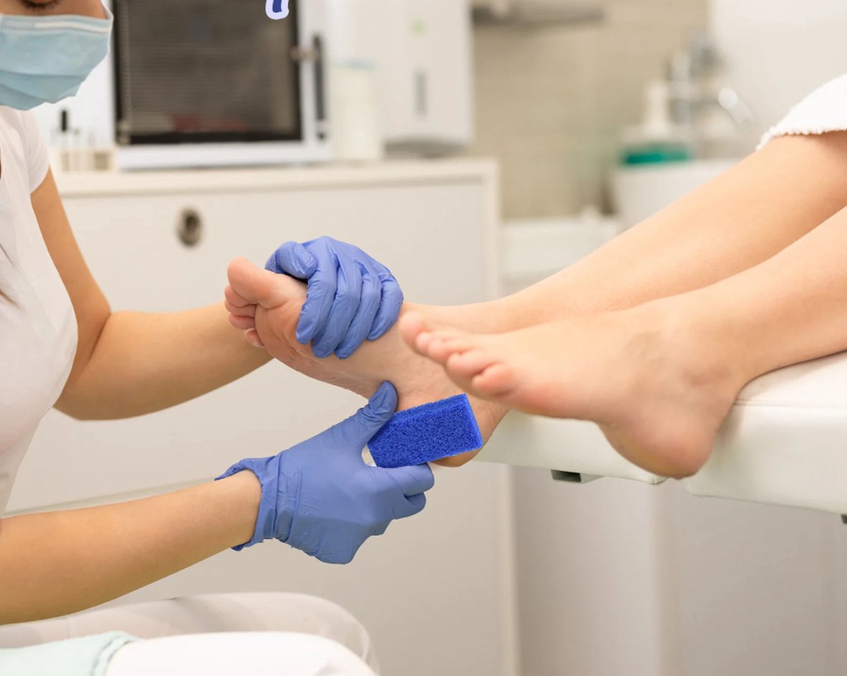 Pumice Stone | Foot Care | 2 PIECES - Image 3