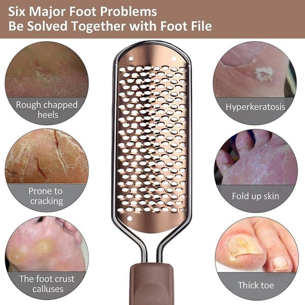 Pedicure Foot File Hard Skin Remover - Large Foot Rasp Colossal Foot Scrub Professional Stainless Steel Hard File for Wet and Dry Feet - Image 3