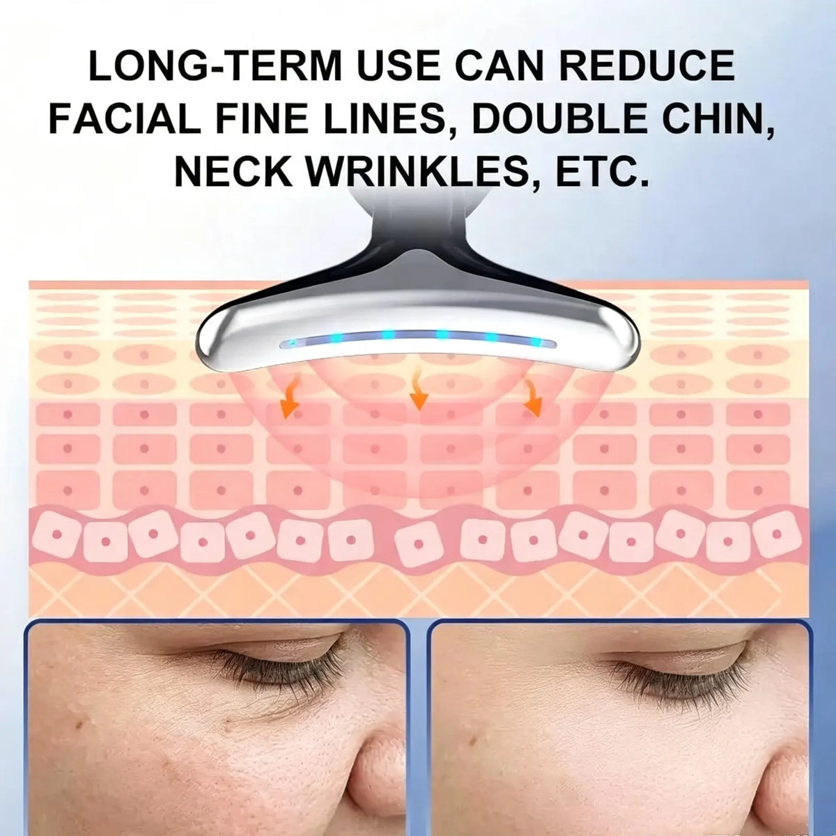 Rejuvenation Massager Neck Anti Wrinkle Face Beauty Device Skin Lifting Tighten White - Image 3