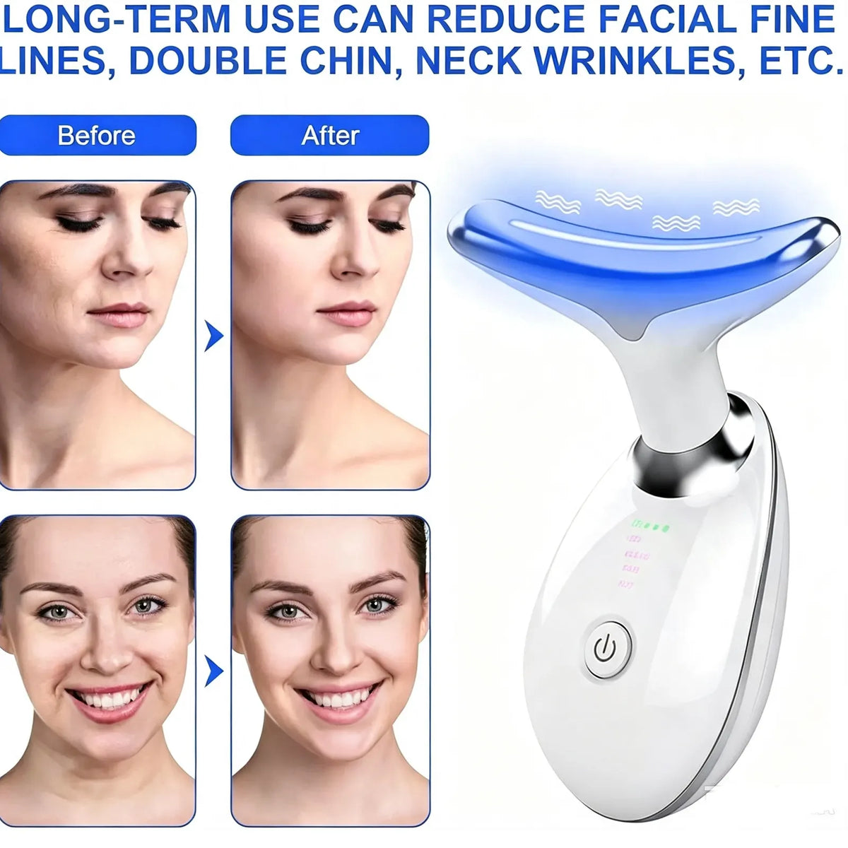 Rejuvenation Massager Neck Anti Wrinkle Face Beauty Device Skin Lifting Tighten White - Image 8