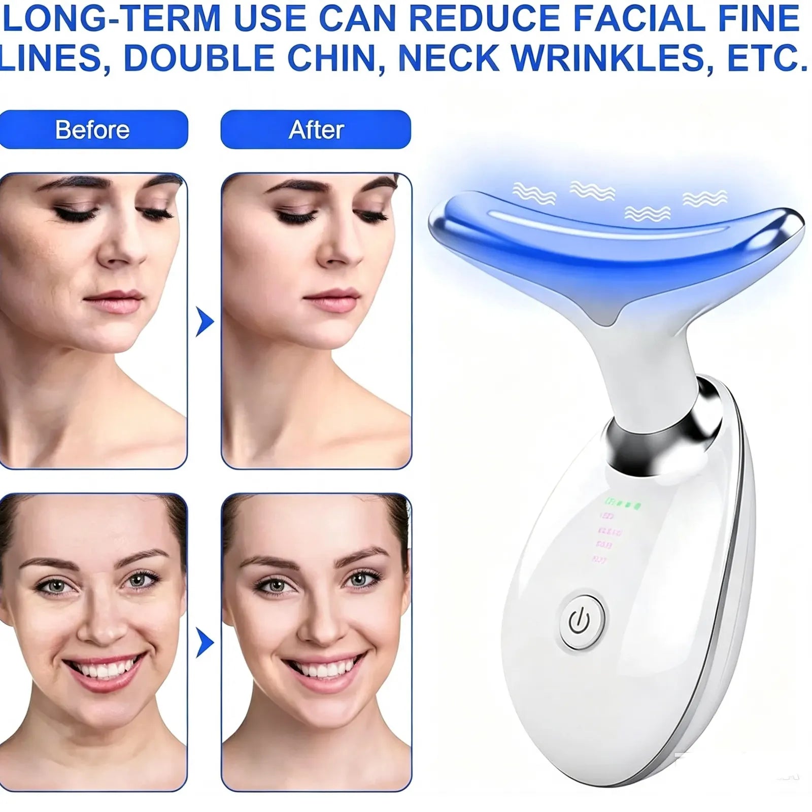 Rejuvenation Massager Neck Anti Wrinkle Face Beauty Device Skin Lifting Tighten White - Image 8