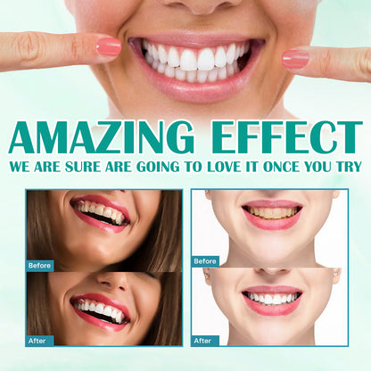 Foam Toothpaste Breath Freshening Whitening Toothpaste Tooth Anti-Moth Mouth Cleaning Tooth Stains And Gum Care - Image 2