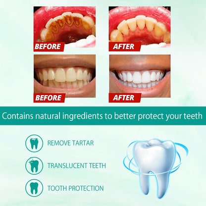 Foam Toothpaste Breath Freshening Whitening Toothpaste Tooth Anti-Moth Mouth Cleaning Tooth Stains And Gum Care - Image 6