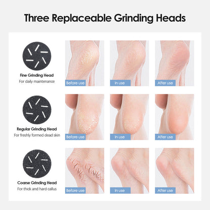 White Rechargeable Electric Foot Grinder with Suction - Complete 10-Piece Pedicure Kit - Image 5