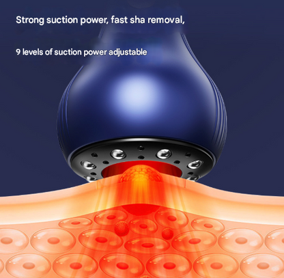 Blue Electric Meridian Scraping Massager with Air Release Valve - Full Body Suction Therapy, 16.6x8.4cm - Image 2