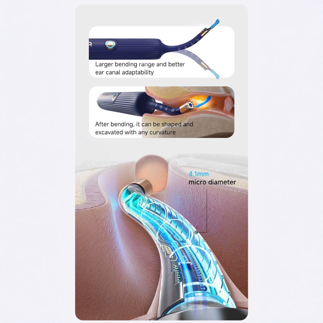 Smart Visual Ear Cleaner with HD Endoscope & Precision Tweezers - Safe for Adults & Children(blue) - Image 5
