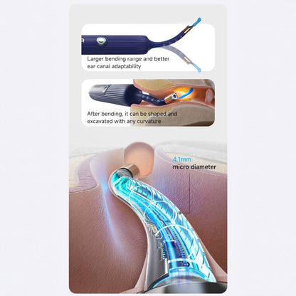 Smart Visual Ear Cleaner with HD Endoscope & Precision Tweezers - Safe for Adults & Children(blue) - Image 5