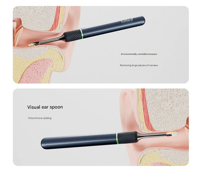 Smart Visual Ear Cleaner with HD Endoscope & Precision Tweezers - Safe for Adults & Children(Dark blue) - Image 4