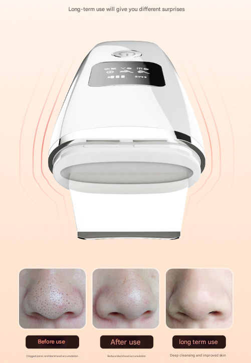 White Professional 4-in-1 Ultrasonic Skin Scrubber - Deep Pore Cleanser, Blackhead Remover & EMS Facial Lifting Tool - Image 4