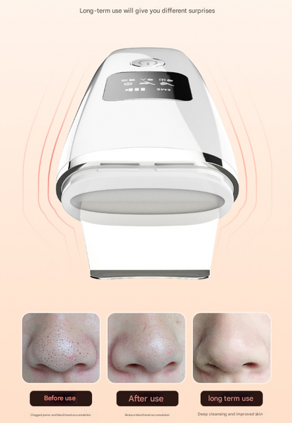 White Professional 4-in-1 Ultrasonic Skin Scrubber - Deep Pore Cleanser, Blackhead Remover & EMS Facial Lifting Tool - Image 4