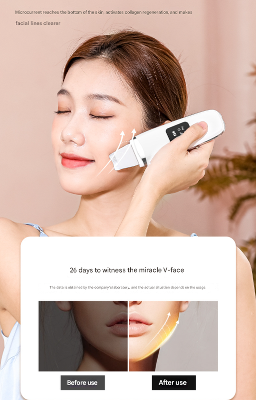 White Professional 4-in-1 Ultrasonic Skin Scrubber - Deep Pore Cleanser, Blackhead Remover & EMS Facial Lifting Tool - Image 8