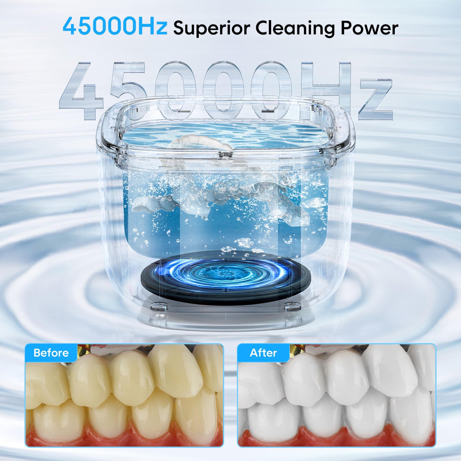 Professional Ultrasonic Cleaner with UV Light - 45000Hz for Dentures, Retainers, Jewelry & More(black) - Image 4