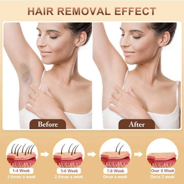IPL Hair Removal Device - 3-in-1 Permanent Hair Reduction, Skin Rejuvenation & Acne Control(white) - Image 2