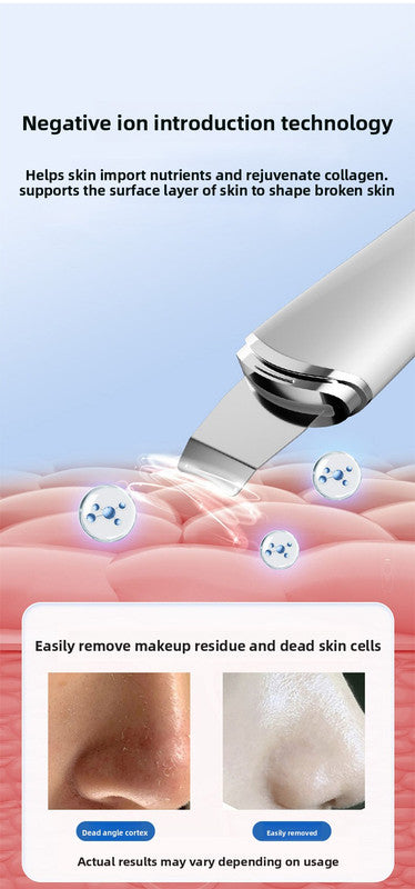 Ultrasonic Skin Scrubber Facial Spatula Blackhead Remover & Pore Cleaner with Ion EMS Lifting Mode Rechargeable Beauty Tool Black - Image 6