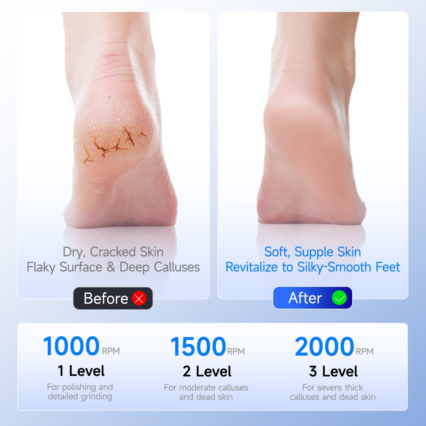White A1 Compact Electric Foot Dead Skin and Callus Remover - IPX6 Pedicure Tool with 3-Speed Mode & Dual 360°Rotating Stainless Steel Heads - Image 3