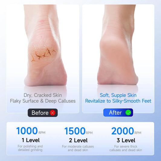 Black A1 Compact Electric Foot Dead Skin and Callus Remover - IPX6 Pedicure Tool with 3-Speed Mode & Dual 360°Rotating Stainless Steel Heads - Image 3
