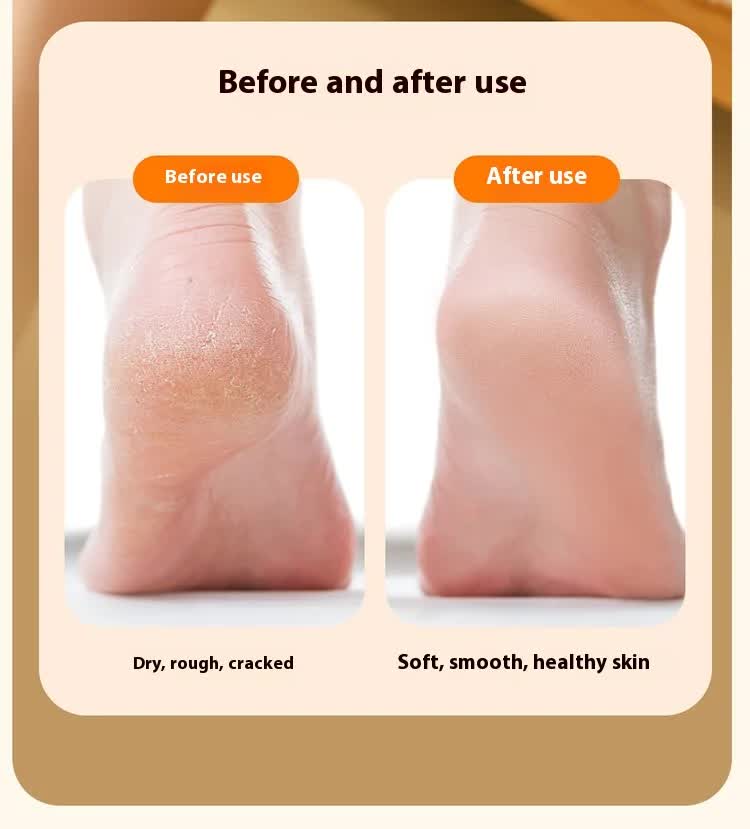 Electric Foot Callus Remover Rechargeable Pedicure Tool with 3 Grinding Heads Portable Dead Skin Exfoliator Ivory White - Image 9