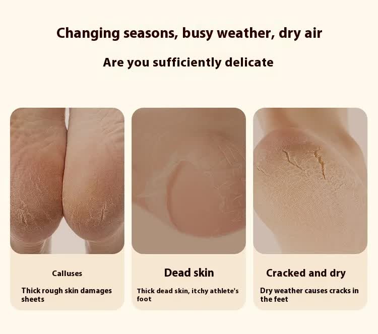 Electric Foot Callus Remover Rechargeable Pedicure Tool with 3 Grinding Heads Portable Dead Skin Exfoliator Peach Pink - Image 4