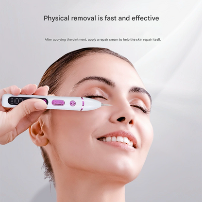 Professional Electric Mole & Dark Spot Remover Pen - Advanced Plasma Ion Technology for Seamless Skin Tag & Freckle Removal (Purple) - Image 2