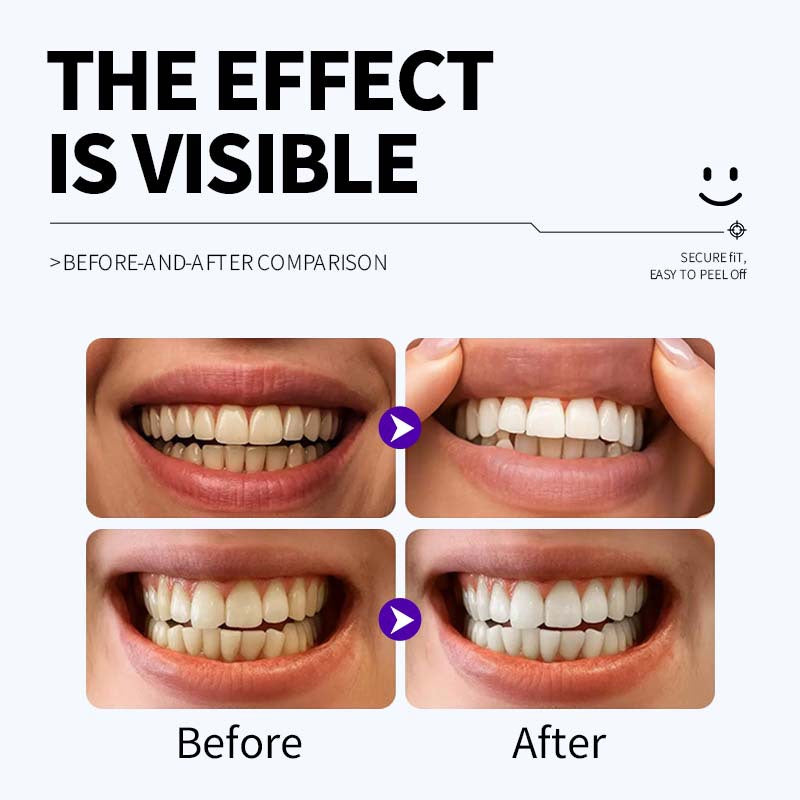 Professional Enamel-Safe Teeth Whitening Strips(12 Strips per Pack) - Antibacterial Gum Care & Deep Cleaning - Image 5