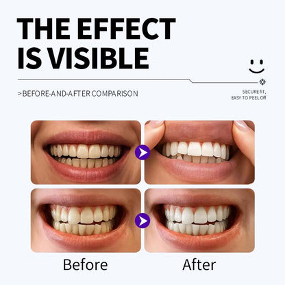 Professional Enamel-Safe Teeth Whitening Strips(12 Strips per Pack) - Antibacterial Gum Care & Deep Cleaning - Image 5