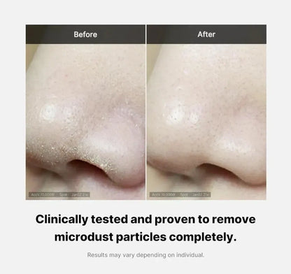 MEDICUBE Zero Foam Cleanser 120g – Deep Cleansing, Pore Care – AU Seller - Image 3